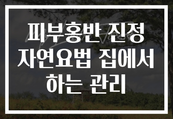 피부홍반 진정 자연요법 집에서 하는 관리