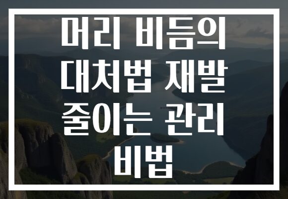 머리 비듬의 대처법 재발 줄이는 관리 비법