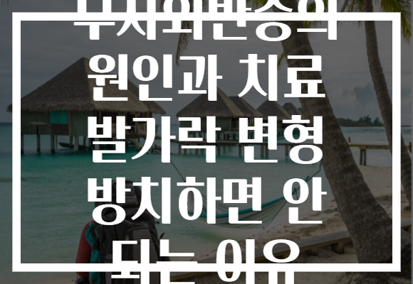 무지외반증의 원인과 치료 발가락 변형 방치하면 안 되는 이유
