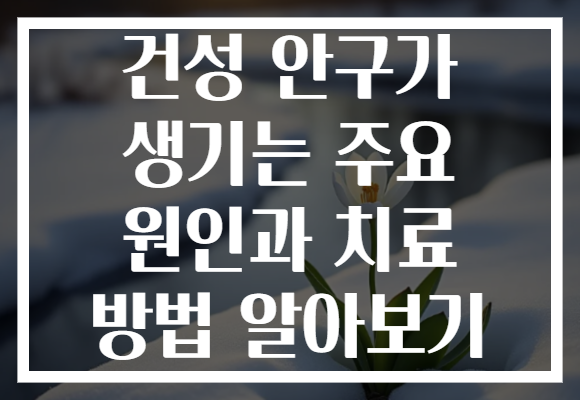 건성 안구가 생기는 주요 원인과 치료 방법 알아보기