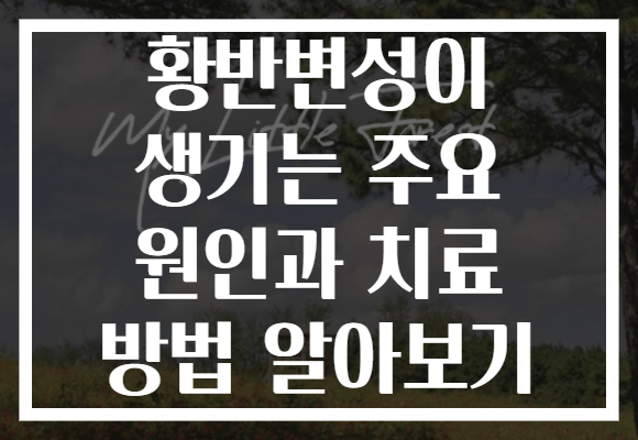 황반변성이 생기는 주요 원인과 치료 방법 알아보기